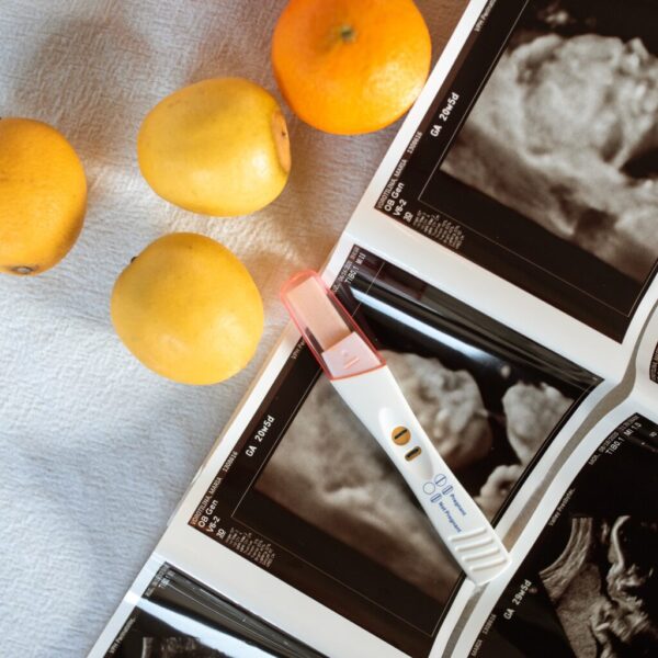 임신 정기 검진